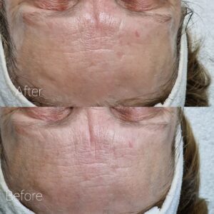 Gezichtsbehandelingen